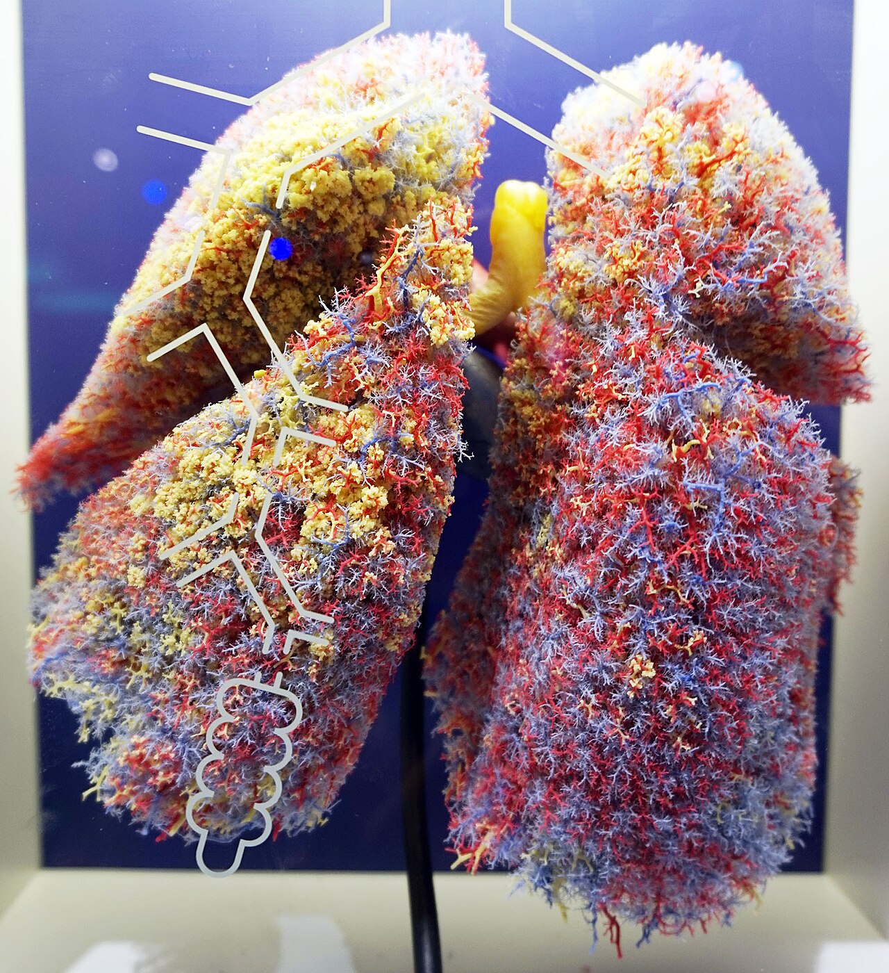 Colourful corrosion cast of the bronchial tree and lung vessels