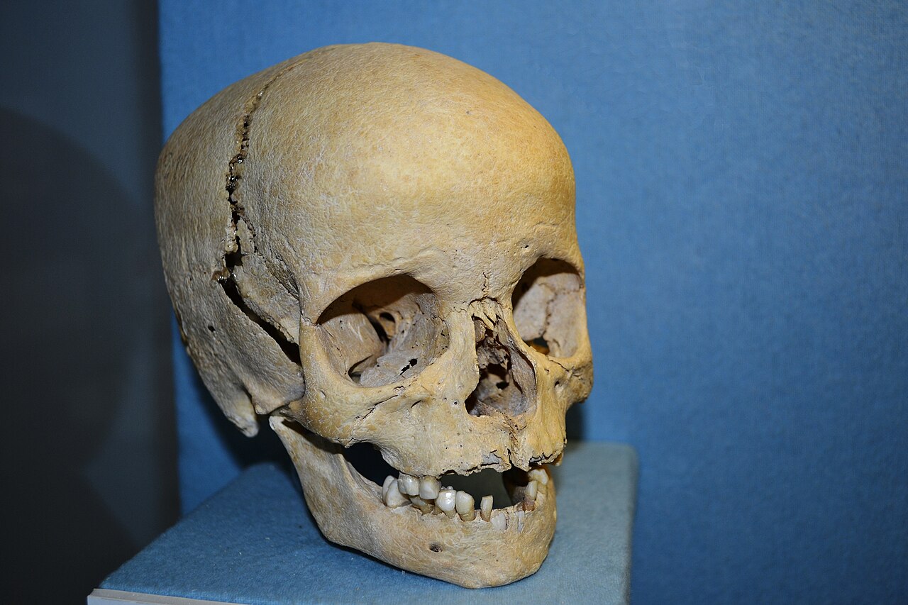 Photograph of a real human skull with jaw and teeth